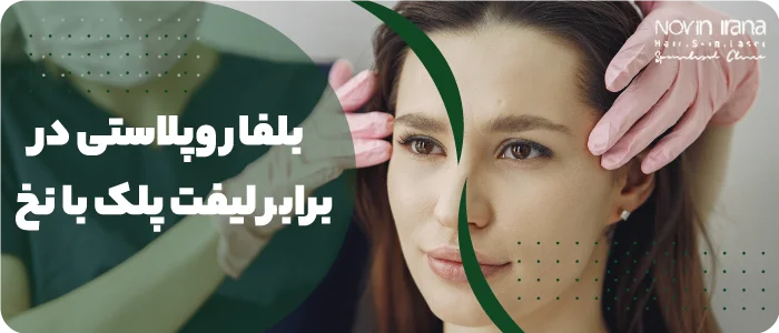 هزینه بلفاروپلاستی در مشهد
